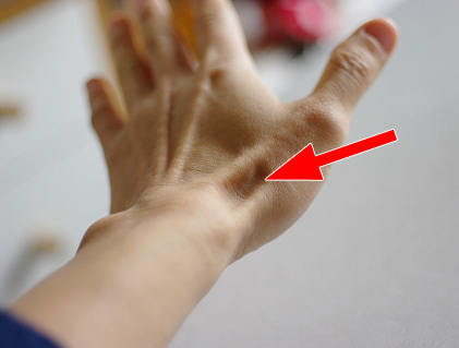 手の親指を伸ばして反らせた時 付け根にできる三角形の窪みの正式名称は 人体 医療